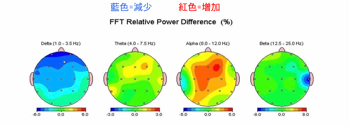 CES對大腦的改變圖