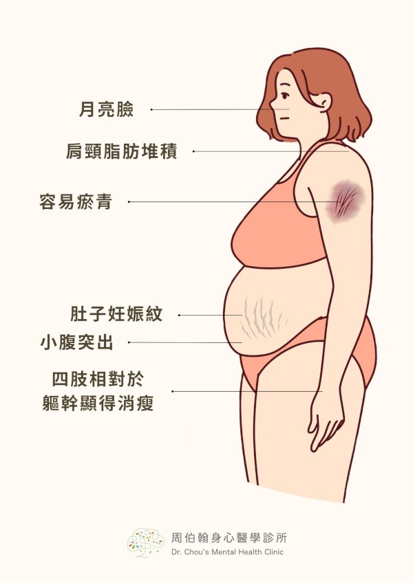 突發憂鬱、失眠與發胖！罕見庫欣氏症候群作怪